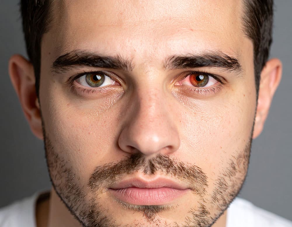 Why do our eyes turn red in photos taken with flash? The answer lies deep inside your eyes—and it’s more than just spooky lighting.