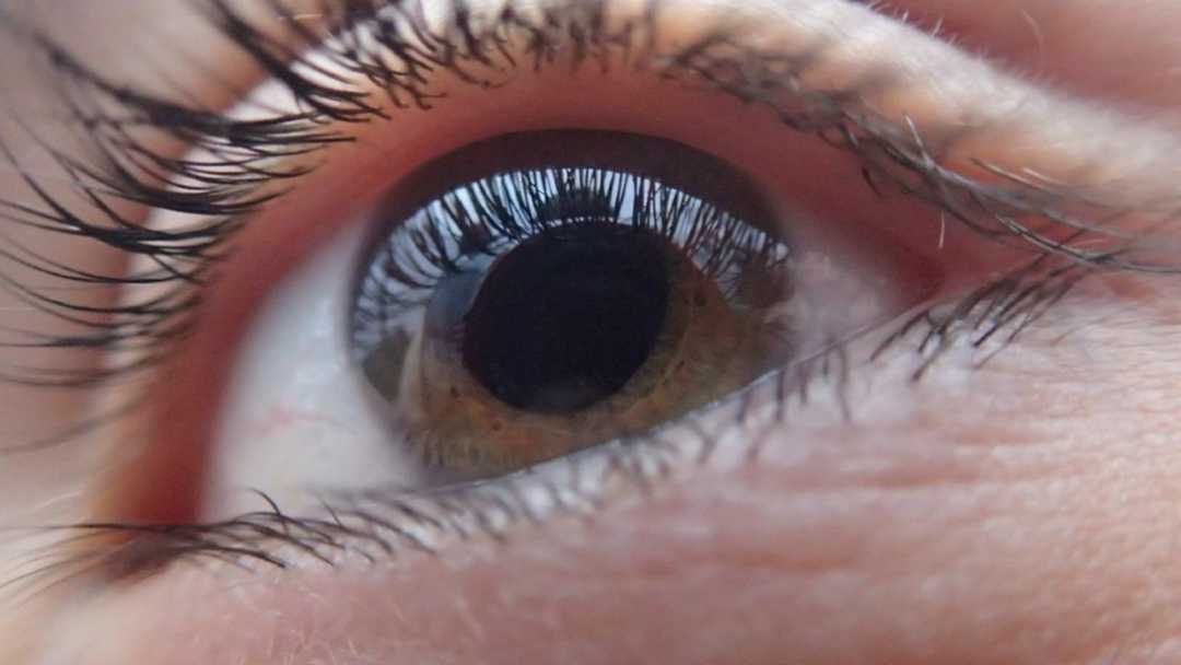 brown eye